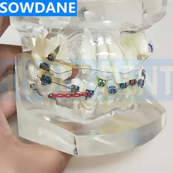 Прозрачная стоматологическая ортодонтическая модель прикуса с ментальными керамическими брекетами, дугообразной проволочной щечной трубкой для общения с пациентом